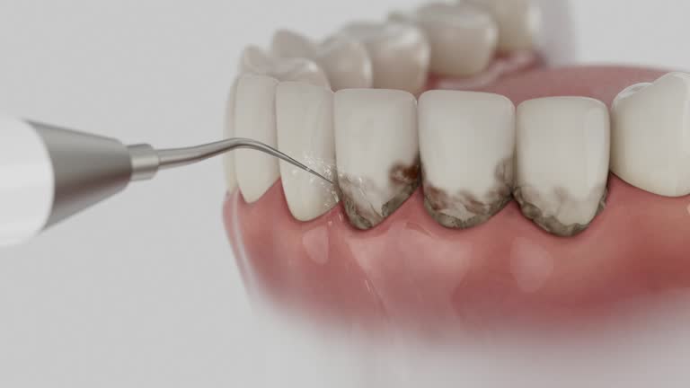 Reliable Dental Implants contractor in Brooklyn Heights, OH by Smile Center Dentistry